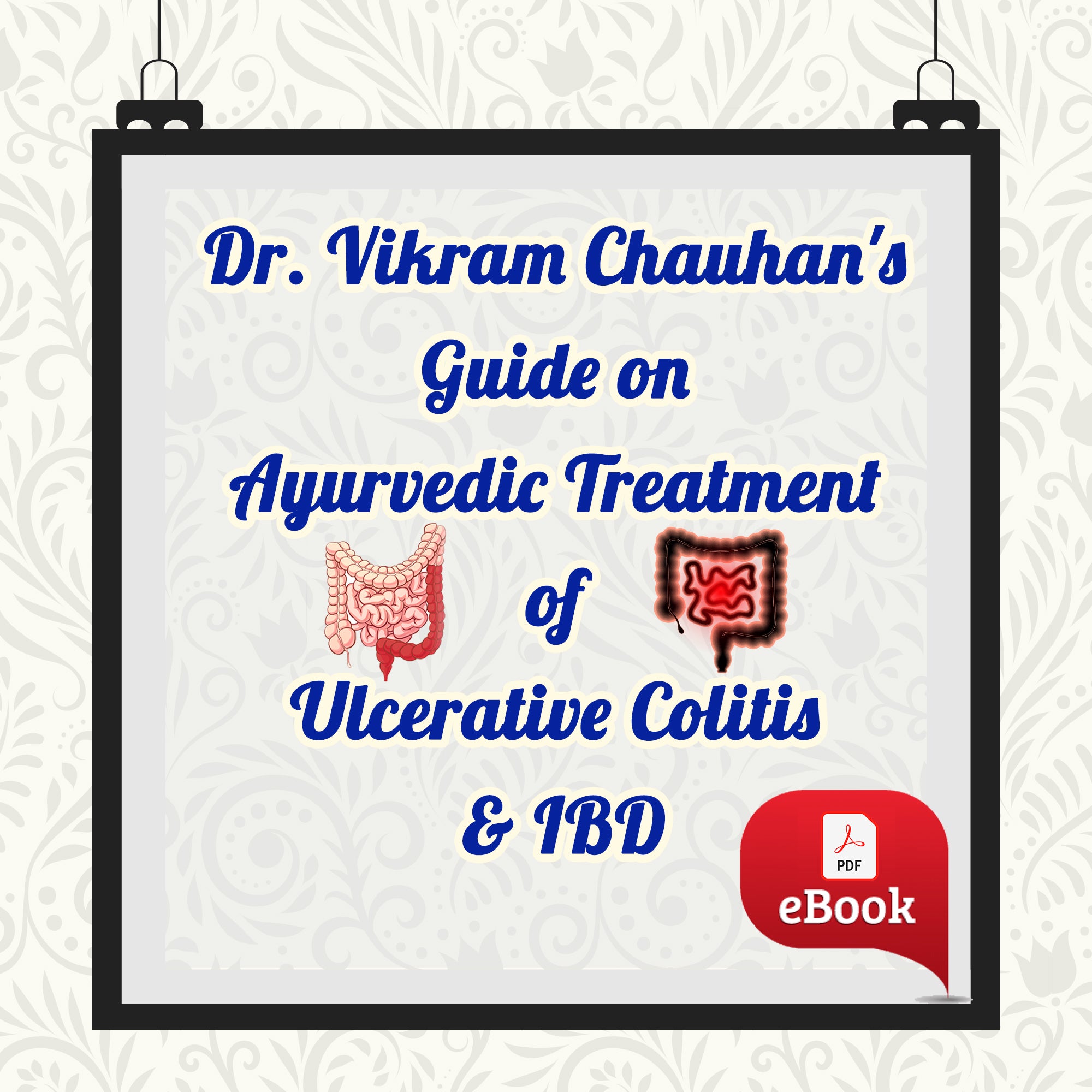 ULCERATIVE COLITIS & IBD (E-BOOK)